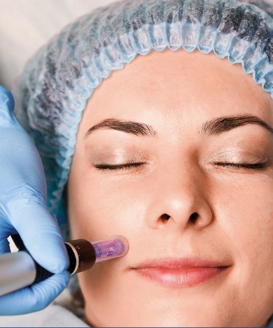 Corso Microneedling e tecniche ancillari